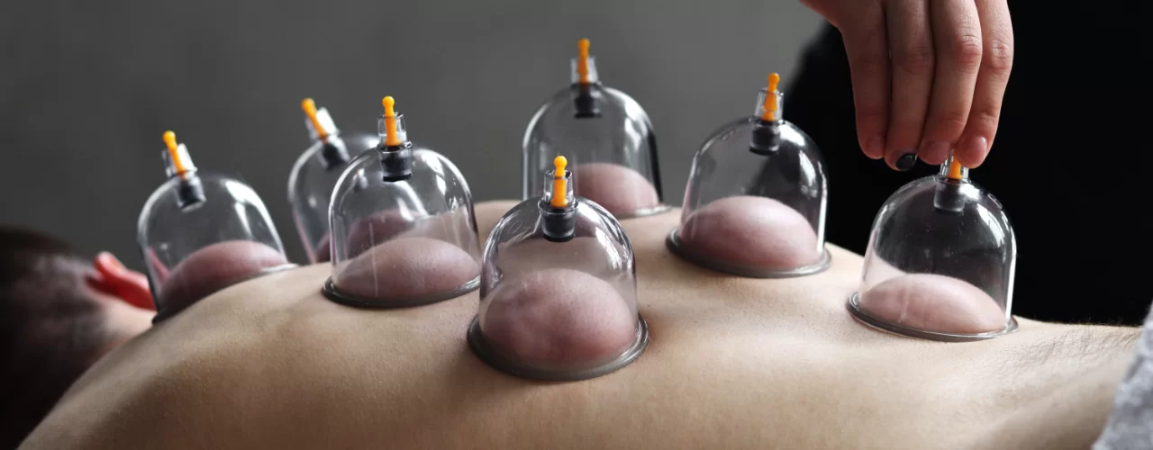 Professional hijama service